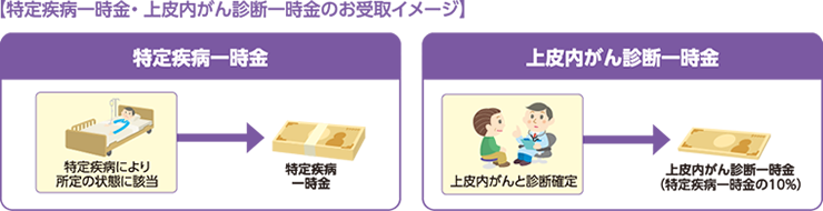 上皮内がんについて